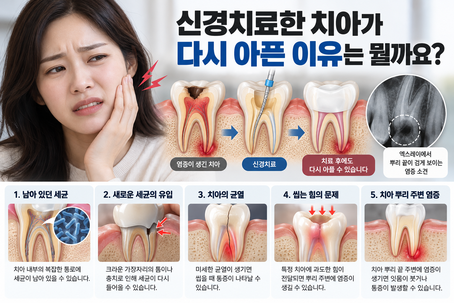 신경치료한 치아가 다시 아픈데 재신경치료를 해야 하나요?
