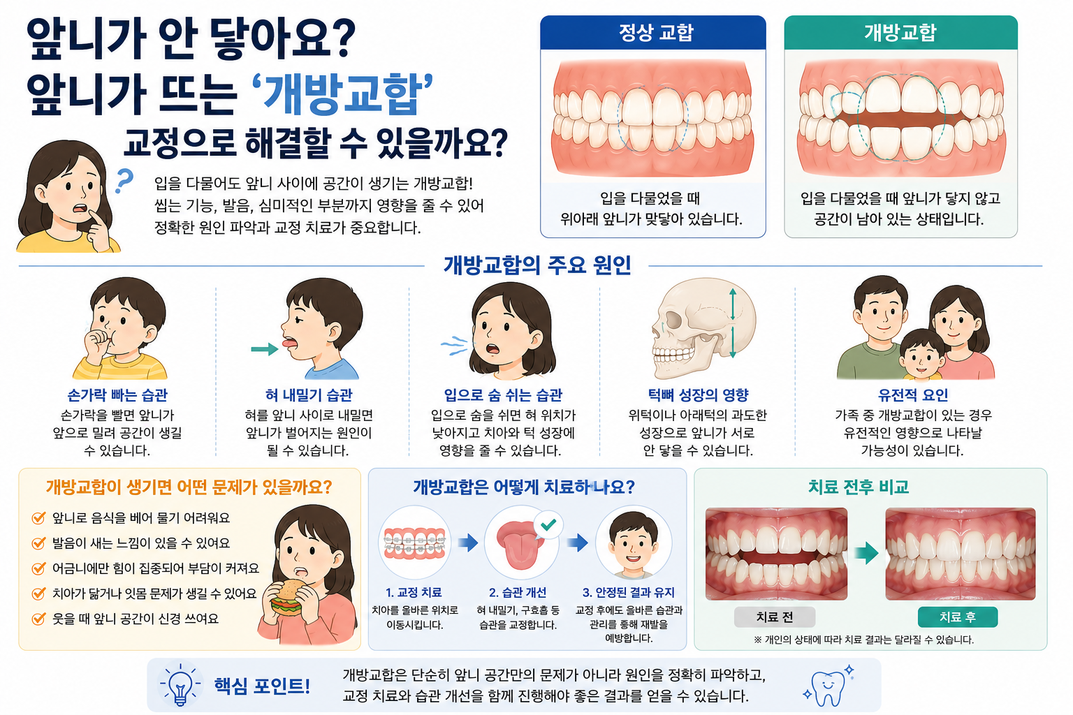 개방교합의 치료