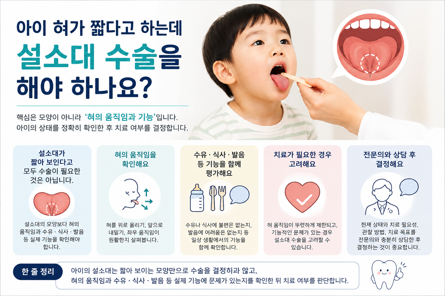 아이 혀가 짧다고 하는데 설소대 수술을 해야 하나요?