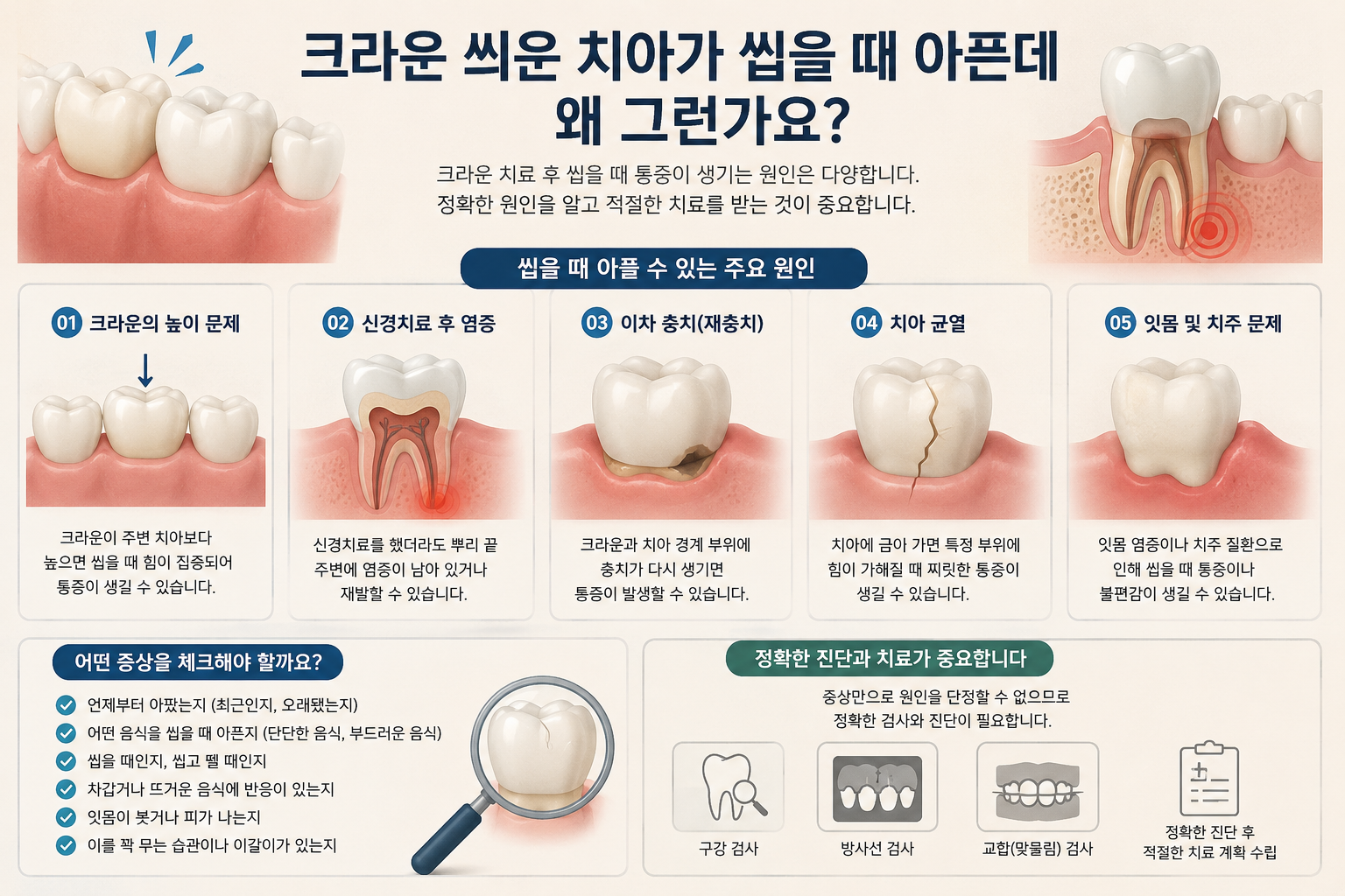 크라운 씌운 치아가 씹을 때 아픈데 왜 그런가요?