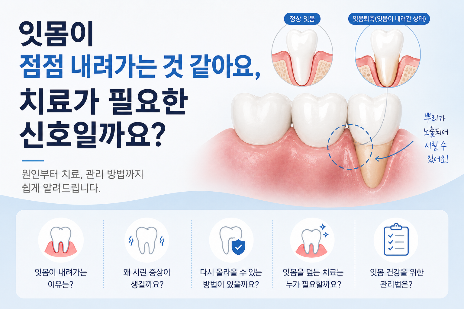 잇몸이 내려가서 치아가 길어 보여요, 다시 올라올 수 있나요?
