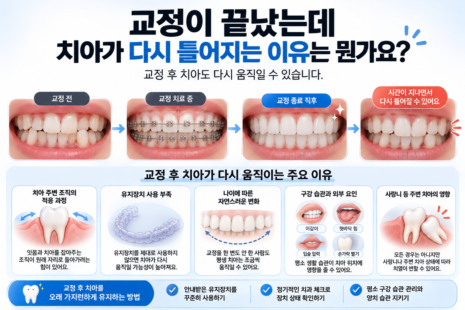 교정 후 치아가 다시 틀어지는 이유는? 유지장치가 중요한 이유