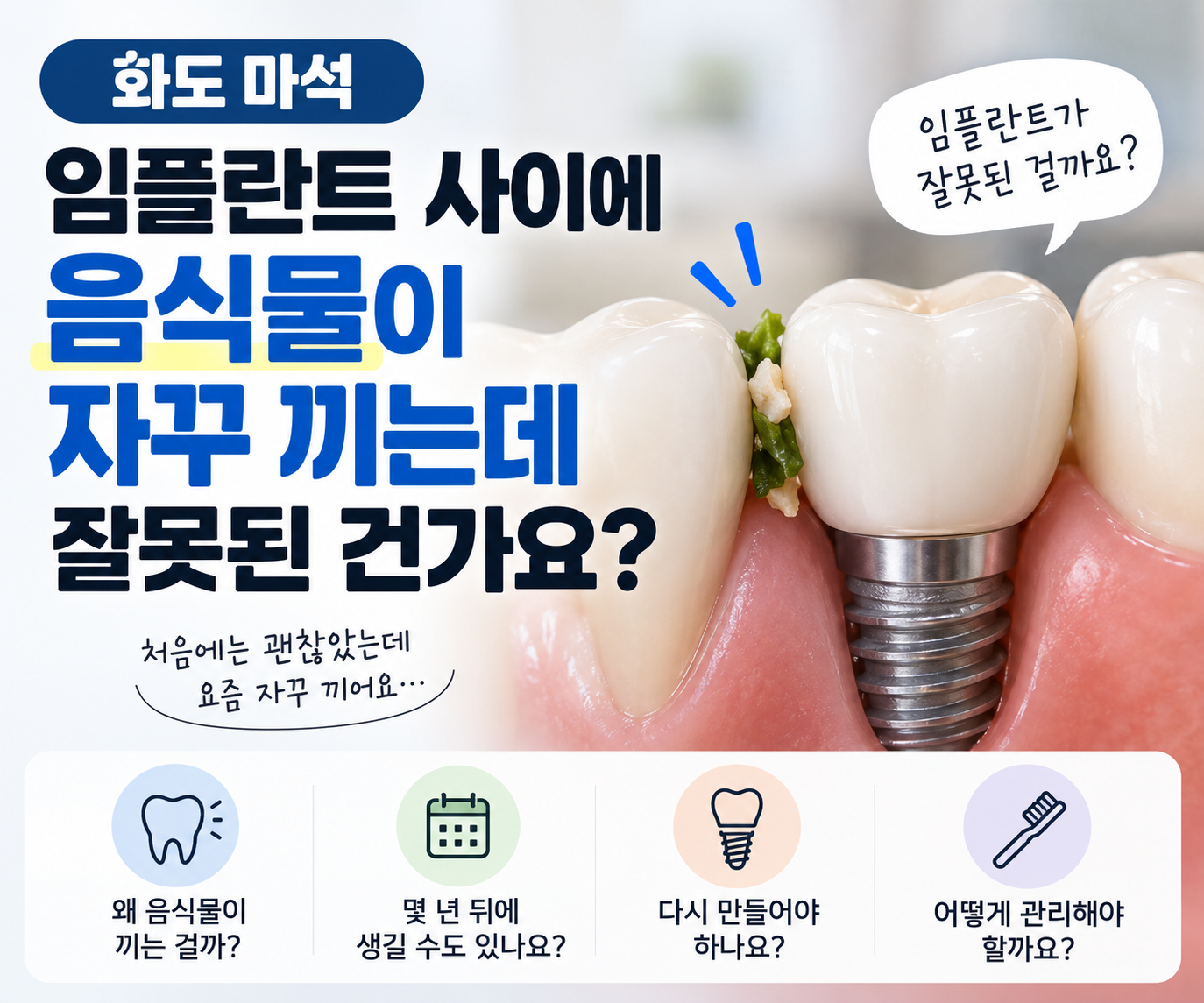 임플란트 사이 음식물 끼임, 잘못된 건가요?