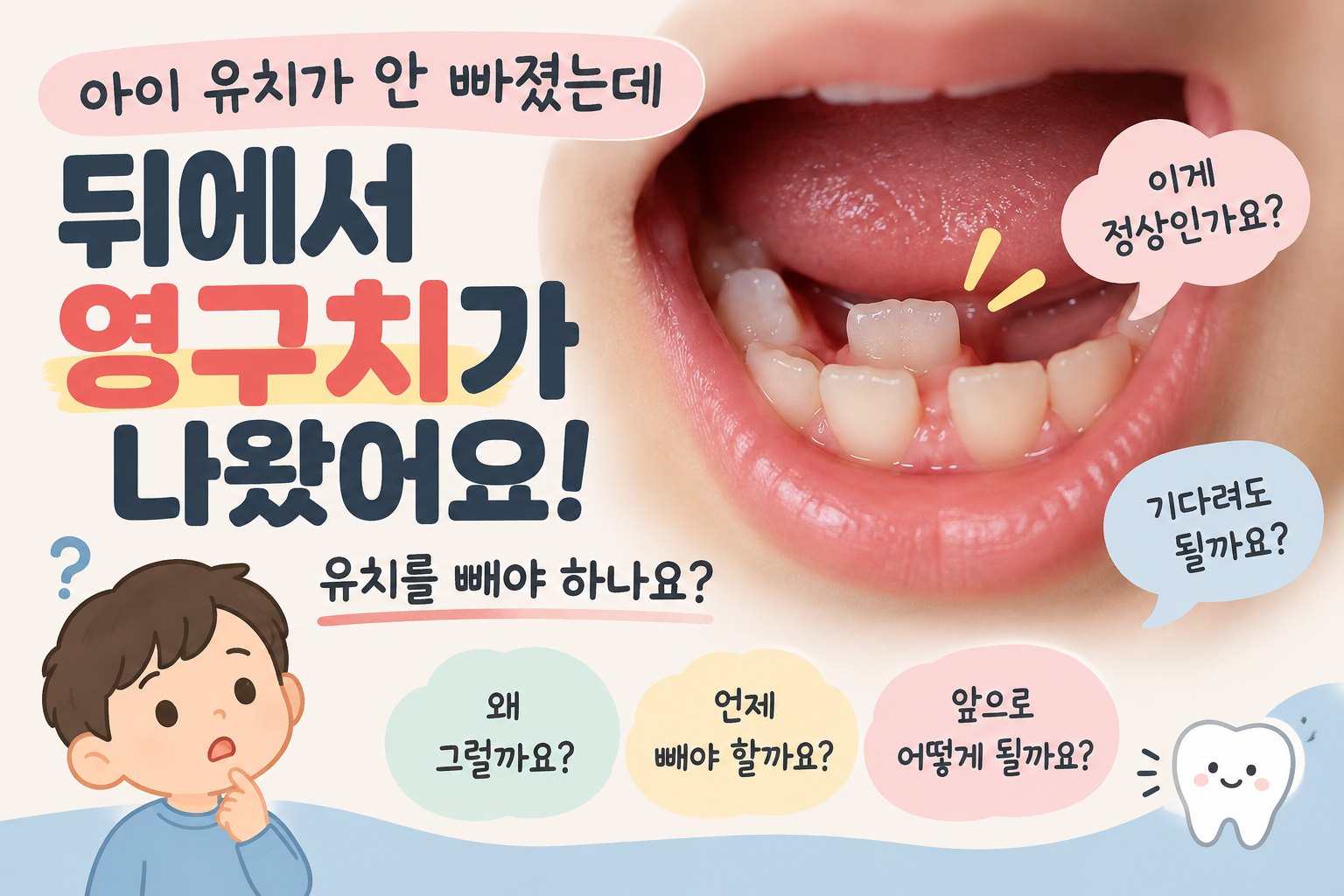 아이 유치가 안 빠졌는데 뒤에서 영구치가 나왔어요, 유치를 빼야 하나요?