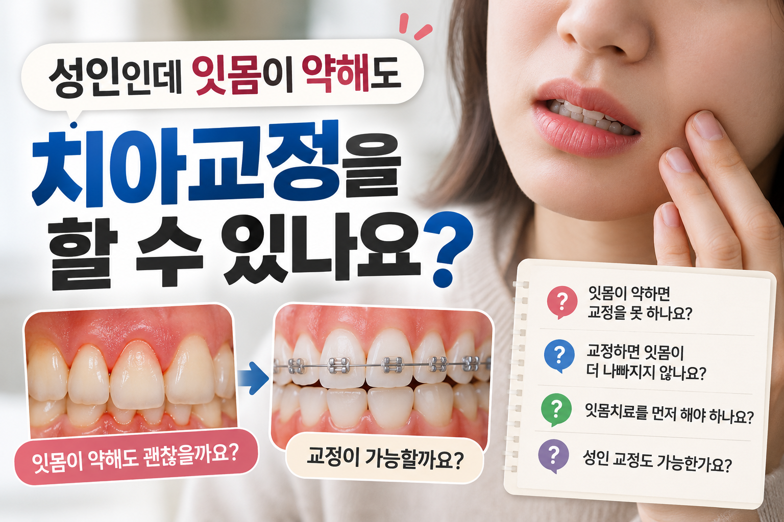 성인인데 잇몸이 약해도 치아교정을 할 수 있나요?
