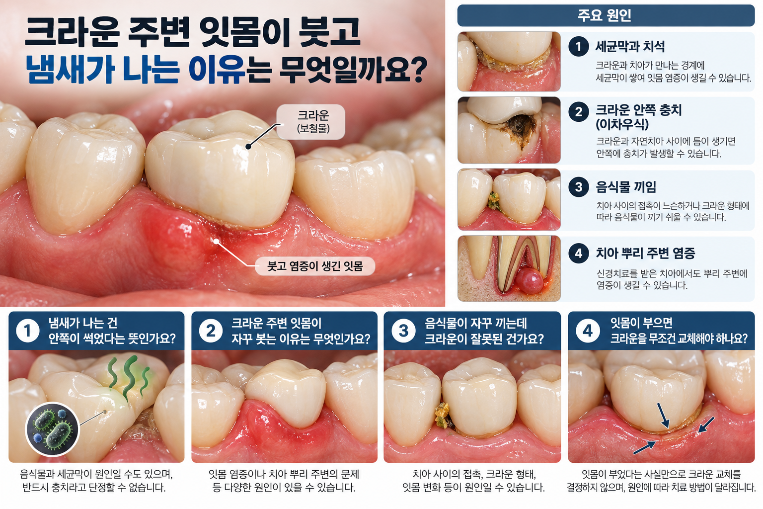 본문에대한 설명